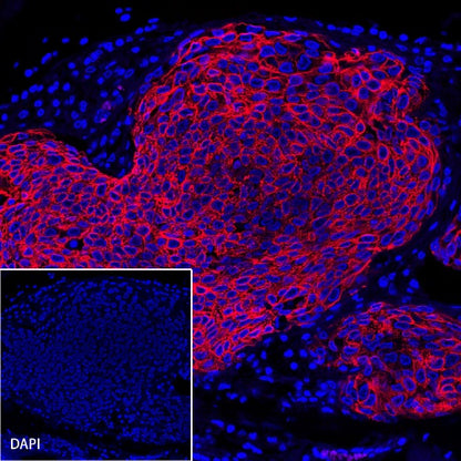 CK-Pan Recombinant Rabbit mAb (Alexa Fluor® 594 Conjugate) (S-P001)