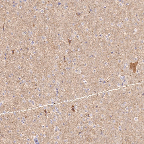 LC3A/B Recombinant Rabbit mAb (S-1367-104)