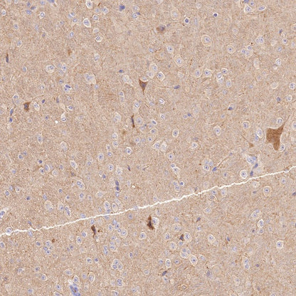 LC3A/B Recombinant Rabbit mAb (S-1367-104)
