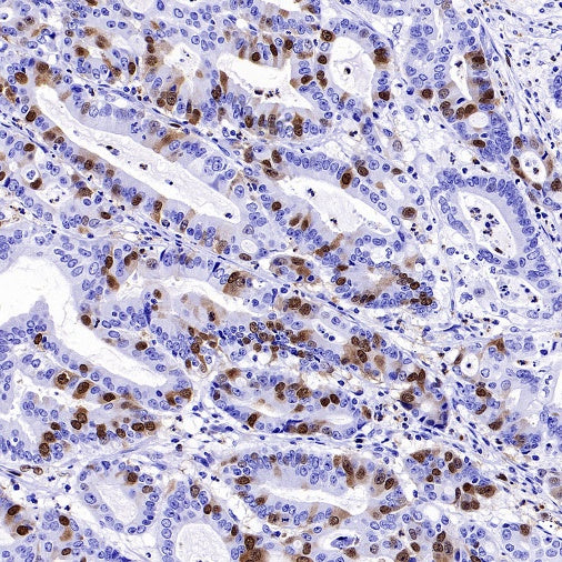 Cyclin A2 Recombinant Rabbit mAb (S-2554-2)