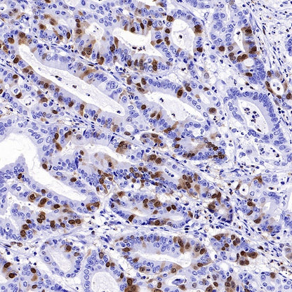 Cyclin A2 Recombinant Rabbit mAb (S-2554-2)