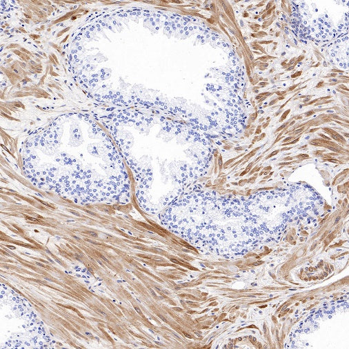 Vinculin Recombinant Rabbit mAb (S-1635-3)