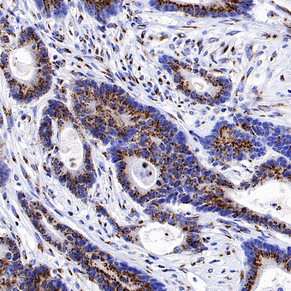 TGN46 Recombinant Rabbit mAb (S-3514-47)