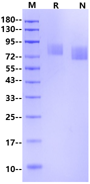 PDGF R alpha/PDGFRA His Tag Protein, Human