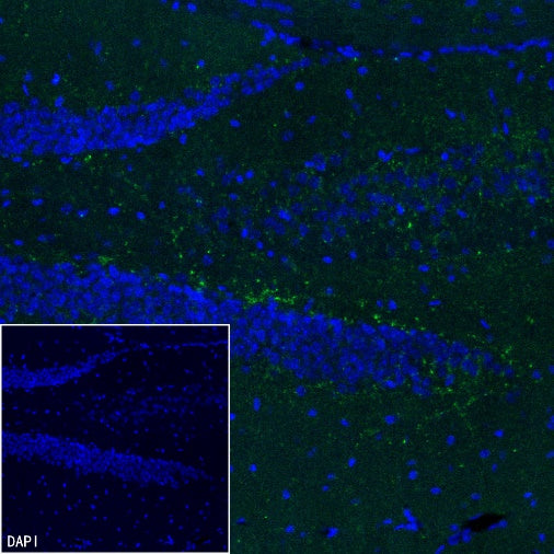 VGLUT3 Recombinant Rabbit mAb (S-2430-26)