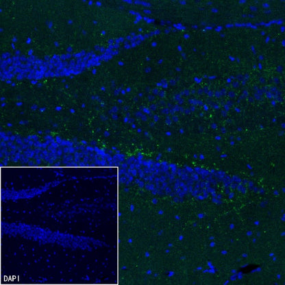 VGLUT3 Recombinant Rabbit mAb (S-2430-26)