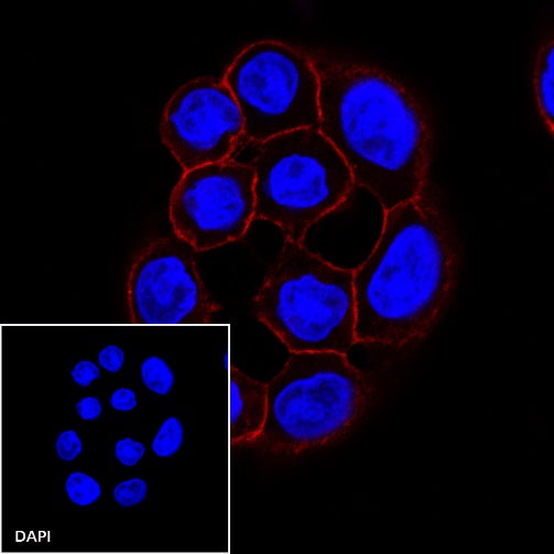 E-Cadherin Recombinant Rabbit mAb (Alexa Fluor® 594 Conjugate) (S-438-5)