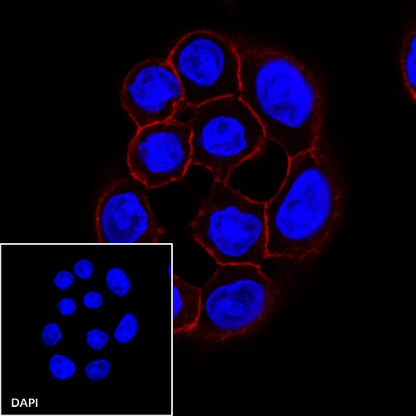 E-Cadherin Recombinant Rabbit mAb (Alexa Fluor® 594 Conjugate) (S-438-5)