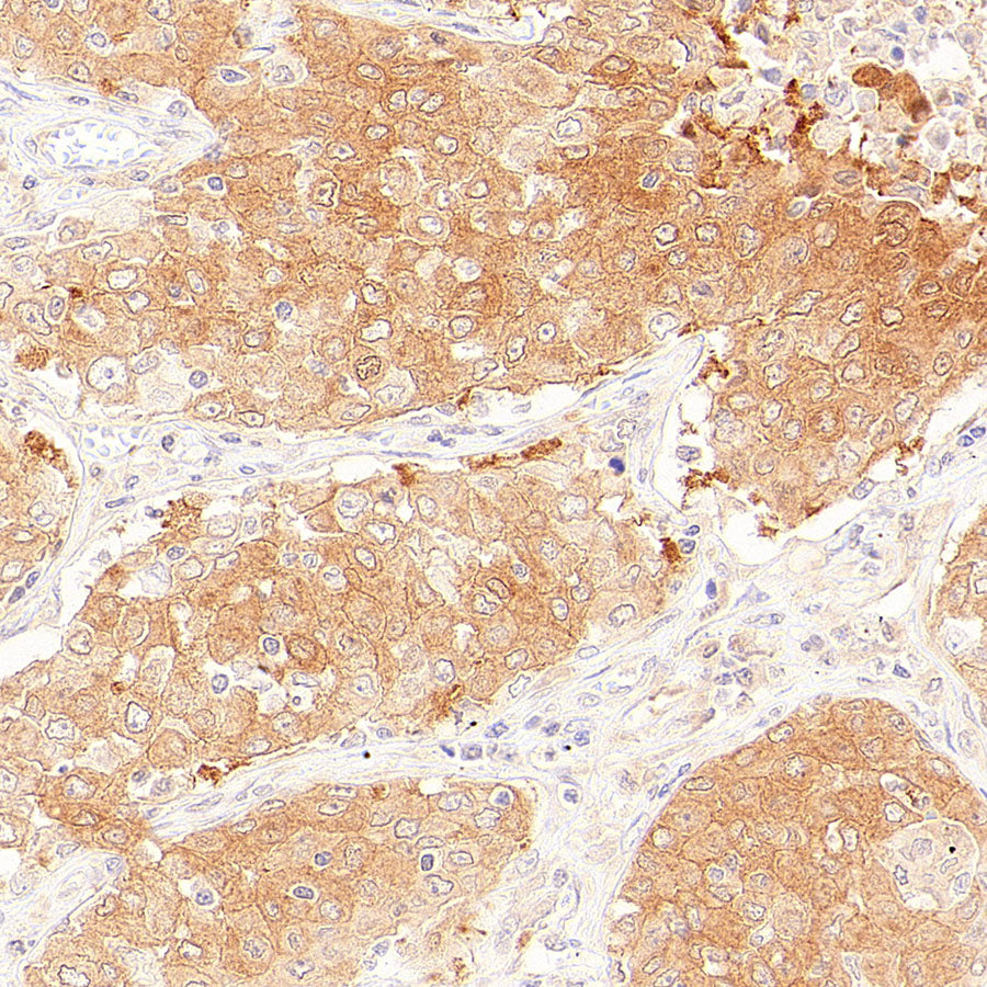 Rad51C Recombinant Rabbit mAb (S-4505-32)