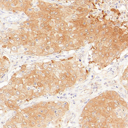 Rad51C Recombinant Rabbit mAb (S-4505-32)