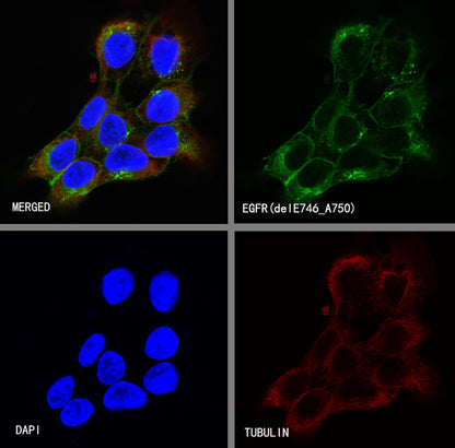 EGFR (delE746-A750) Recombinant Rabbit mAb (S-451-168)
