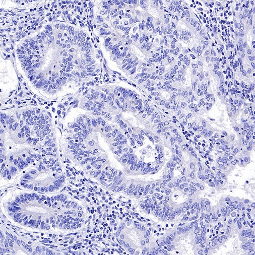 OTP Recombinant Rabbit mAb (SDT-2002-175)
