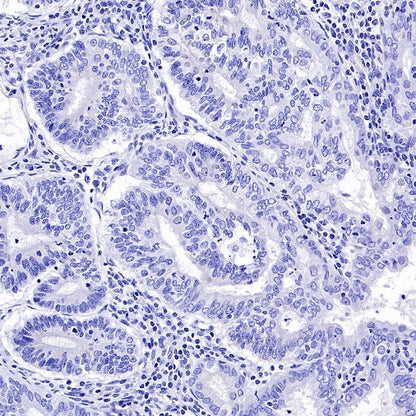 OTP Recombinant Rabbit mAb (SDT-2002-175)