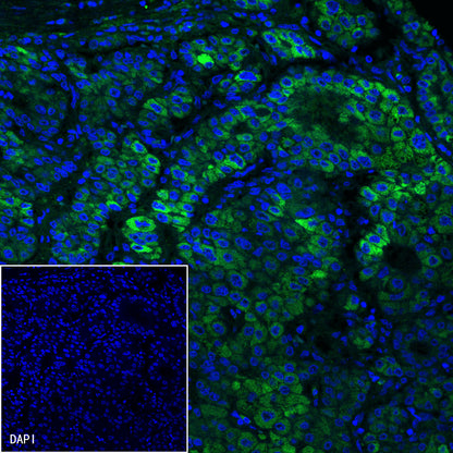 Glypican-3 Recombinant Rabbit mAb,PBS Only (SDT-R032)