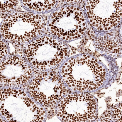 Histone H4 (acetyl K16) Recombinant Rabbit mAb (S-1482-12)