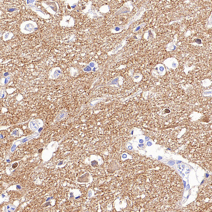 AP-2α Recombinant Rabbit mAb (S-4444-44)