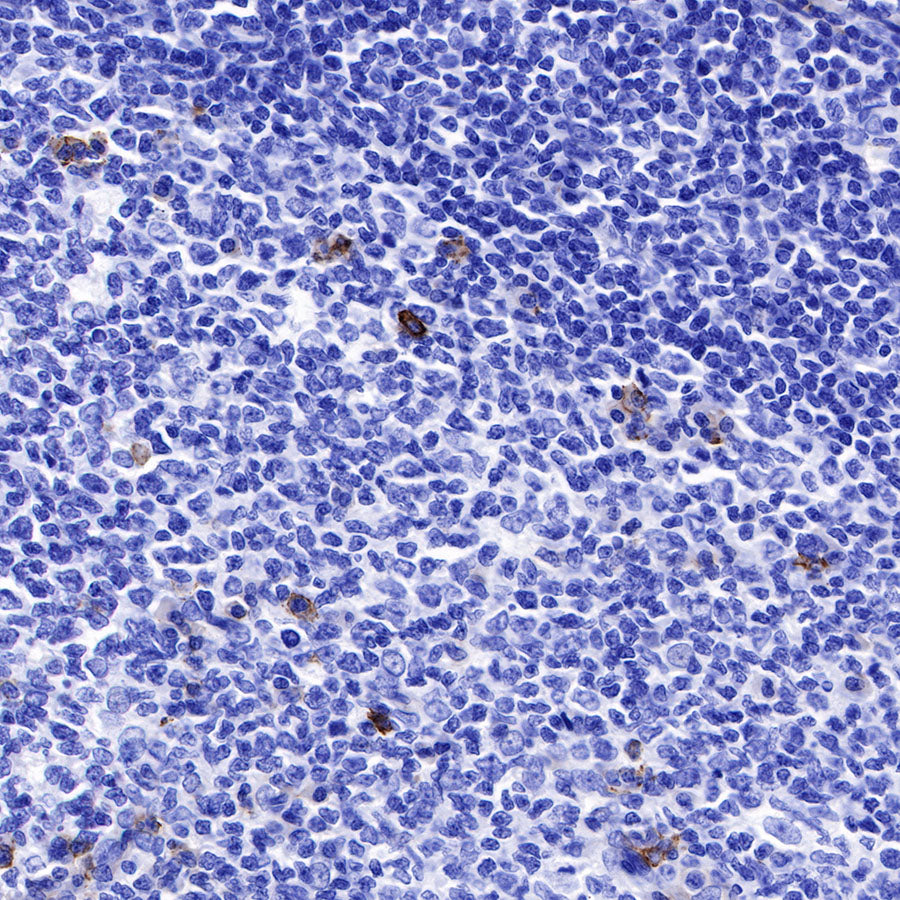 CD138 Recombinant Rabbit mAb,PBS Only (SDT-R120)