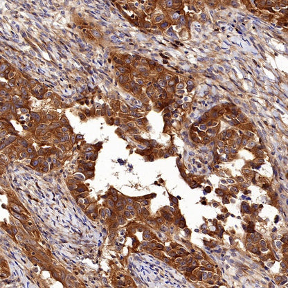 NF-κB2 p100/p52 Recombinant Rabbit mAb (S-2502-70)
