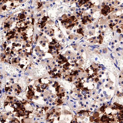 Prolactin/PRL Recombinant Rabbit mAb (SDT-235-13)