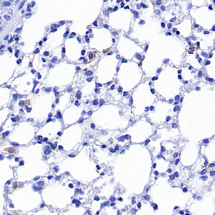 PD-L1 Recombinant Rabbit mAb (S-5311)