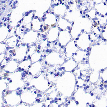 PD-L1 Recombinant Rabbit mAb (S-5311)
