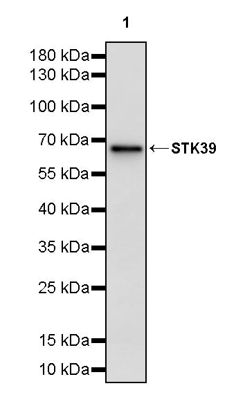 STK39 Recombinant Rabbit mAb (S-3630-15)