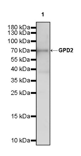 GPD2 Recombinant Rabbit mAb (S-2941-41)