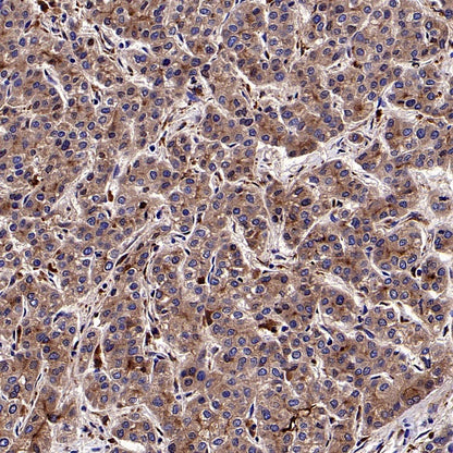 AACT Recombinant Rabbit mAb (S-897-109)