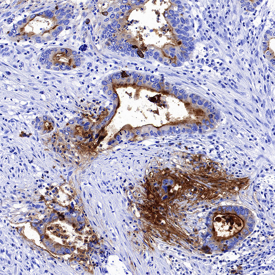 MUC17 Recombinant Rabbit mAb (SDT-3951-108)