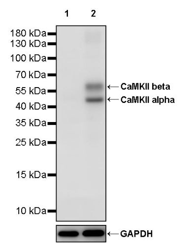 CaMKII alpha Recombinant Rabbit mAb (S-2451-54)