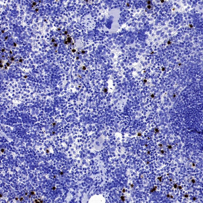 Lipocalin-2/NGAL Recombinant Rabbit mAb (S-2280-129)