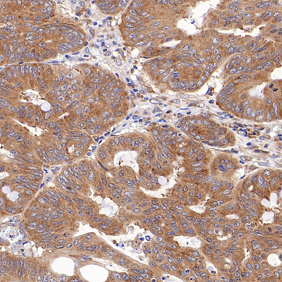 RPLP0 Rabbit Polyclonal Antibody