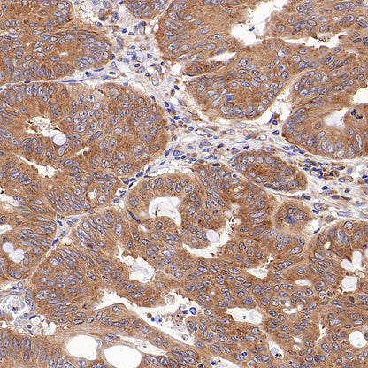 RPLP0 Rabbit Polyclonal Antibody
