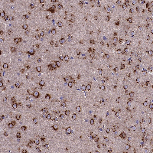 GORASP2 Recombinant Rabbit mAb (S-2526-47)