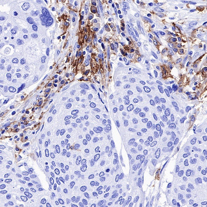 FcγRIIB Recombinant Rabbit mAb (S-R335)