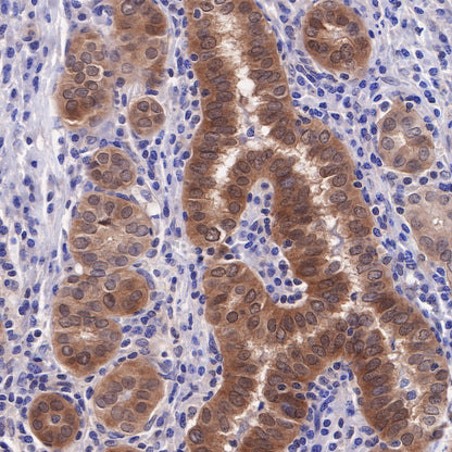 Akt (pan) Recombinant Rabbit mAb (SDT-R169)