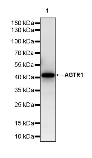 AGTR1 Recombinant Rabbit mAb (S-2447-22)