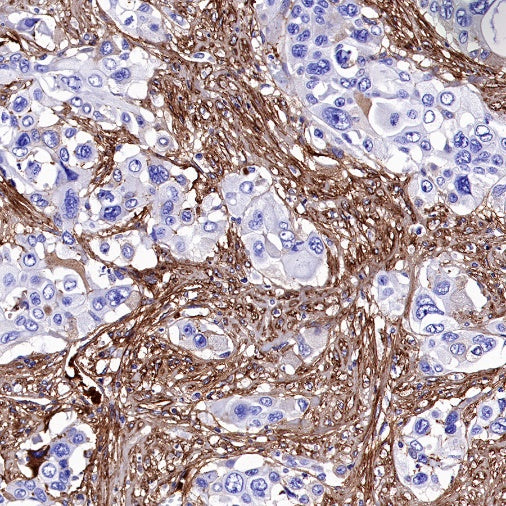 Fibronectin Recombinant Rabbit mAb (S-1475-79)