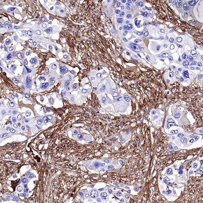 Fibronectin Recombinant Rabbit mAb (S-1475-79)