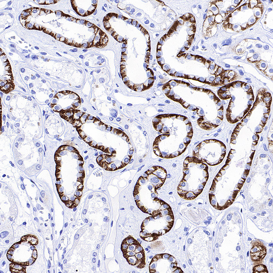BSND Recombinant Rabbit mAb (S-3815-70)