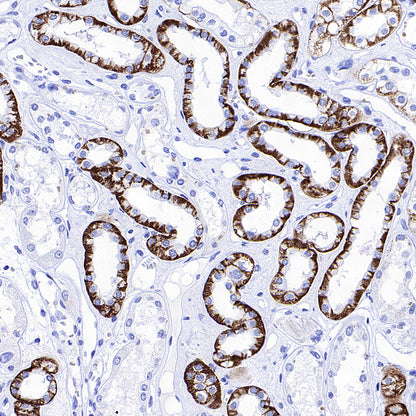 BSND Recombinant Rabbit mAb (S-3815-70)