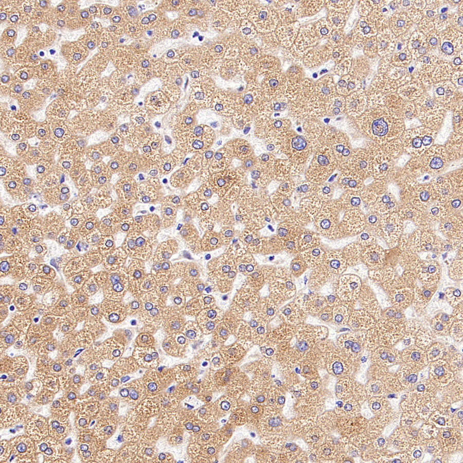 CDS2 Recombinant Rabbit mAb (S-3670-56)