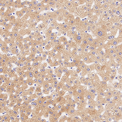 CDS2 Recombinant Rabbit mAb (S-3670-56)