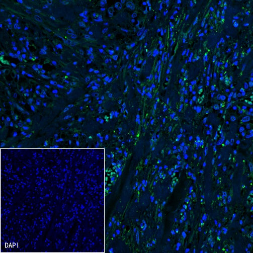 Podoplanin (D2-40) Recombinant Rabbit mAb (Alexa Fluor® 488 Conjugate) (SDT-1178-8)