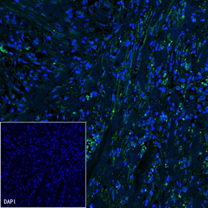 Podoplanin (D2-40) Recombinant Rabbit mAb (Alexa Fluor® 488 Conjugate) (SDT-1178-8)