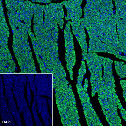 Myosin Light Chain 2/MLC-2V Rabbit Polyclonal Antibody