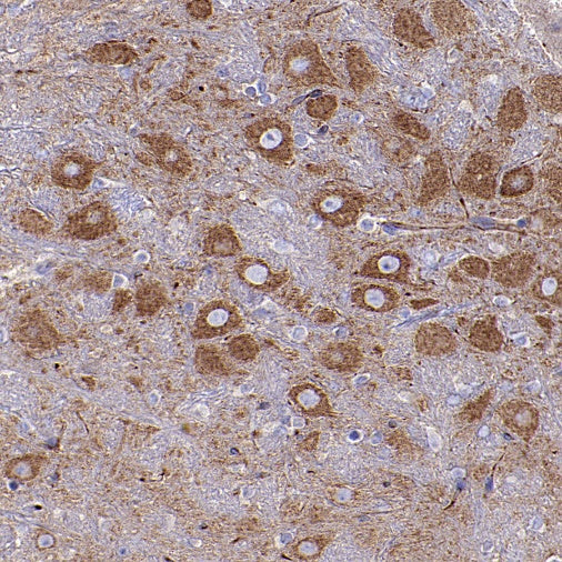 FUNDC1 Rabbit Polyclonal Antibody