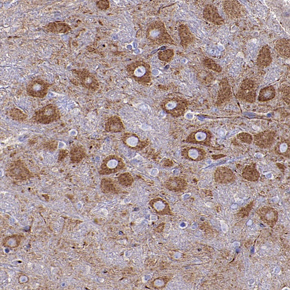 FUNDC1 Rabbit Polyclonal Antibody