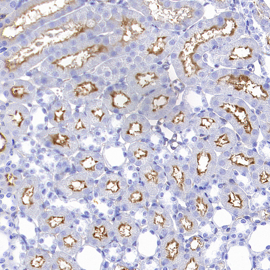 FOLR1 Recombinant Rabbit mAb (SDT-3635-124)