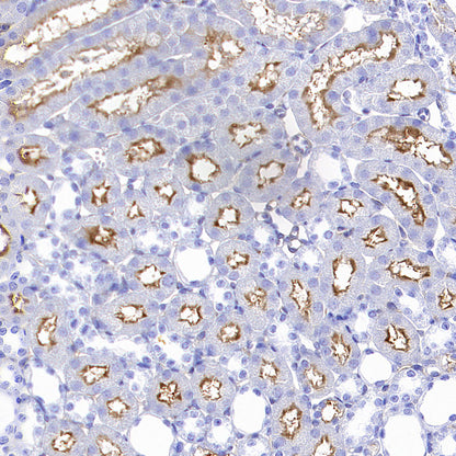 FOLR1 Recombinant Rabbit mAb (SDT-3635-124)